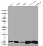 UFC1 Antibody in Western Blot (WB)