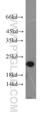 UFC1 Antibody in Western Blot (WB)