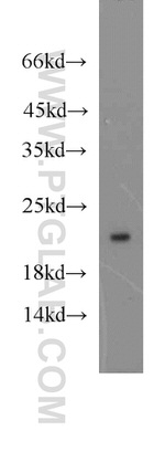 UFC1 Antibody in Western Blot (WB)
