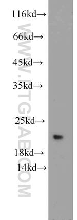UFC1 Antibody in Western Blot (WB)