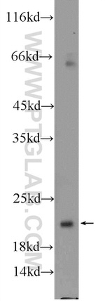 UFC1 Antibody in Western Blot (WB)