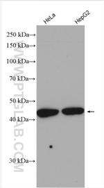 RBM41 Antibody in Western Blot (WB)