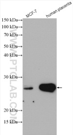Grancalcin Antibody in Western Blot (WB)