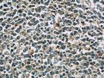 TNFAIP8 Antibody in Immunohistochemistry (Paraffin) (IHC (P))