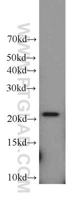 TNFAIP8 Antibody in Western Blot (WB)
