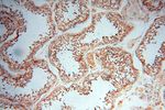 SMPX Antibody in Immunohistochemistry (Paraffin) (IHC (P))