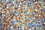 SMPX Antibody in Immunohistochemistry (Paraffin) (IHC (P))