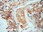 SMPX Antibody in Immunohistochemistry (Paraffin) (IHC (P))