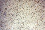 SMPX Antibody in Immunohistochemistry (Paraffin) (IHC (P))