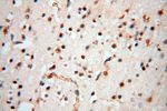SMPX Antibody in Immunohistochemistry (Paraffin) (IHC (P))