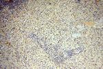 SMPX Antibody in Immunohistochemistry (Paraffin) (IHC (P))