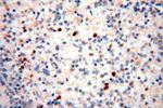 SMPX Antibody in Immunohistochemistry (Paraffin) (IHC (P))