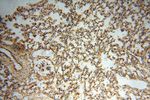 SMPX Antibody in Immunohistochemistry (Paraffin) (IHC (P))
