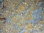 SMPX Antibody in Immunohistochemistry (Paraffin) (IHC (P))