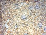 SMPX Antibody in Immunohistochemistry (Paraffin) (IHC (P))