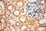 SMPX Antibody in Immunohistochemistry (Paraffin) (IHC (P))