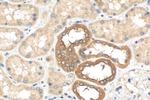 SMPX Antibody in Immunohistochemistry (Paraffin) (IHC (P))