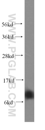 SMPX Antibody in Western Blot (WB)