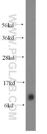 SMPX Antibody in Western Blot (WB)