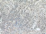 S100A8 Antibody in Immunohistochemistry (Paraffin) (IHC (P))