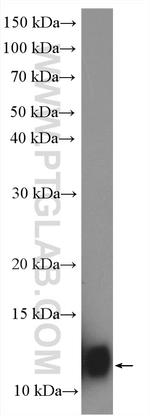 S100A8 Antibody in Western Blot (WB)