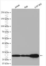 BAP29 Antibody in Western Blot (WB)