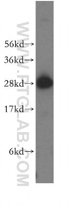 BAP29 Antibody in Western Blot (WB)