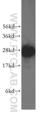 BAP29 Antibody in Western Blot (WB)