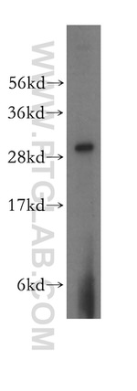 CIP29 Antibody in Western Blot (WB)