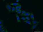 RPL29 Antibody in Immunocytochemistry (ICC/IF)