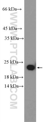 RPL29 Antibody in Western Blot (WB)