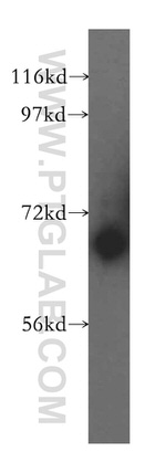 LRCH3 Antibody in Western Blot (WB)