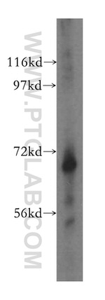 LRCH3 Antibody in Western Blot (WB)