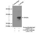 Calpain S2 Antibody in Immunoprecipitation (IP)