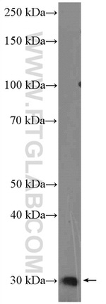 Calpain S2 Antibody in Western Blot (WB)