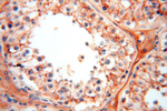 FXYD6 Antibody in Immunohistochemistry (Paraffin) (IHC (P))