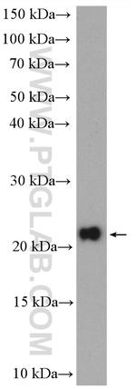 DNAL1 Antibody in Western Blot (WB)