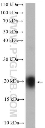 DNAL1 Antibody in Western Blot (WB)