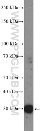 ANP32A Antibody in Western Blot (WB)