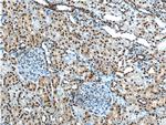ANP32A Antibody in Immunohistochemistry (Paraffin) (IHC (P))