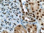 ANP32A Antibody in Immunohistochemistry (Paraffin) (IHC (P))