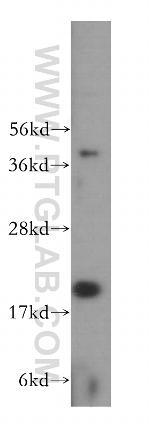 Centrin 3 Antibody in Western Blot (WB)