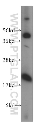 Centrin 3 Antibody in Western Blot (WB)