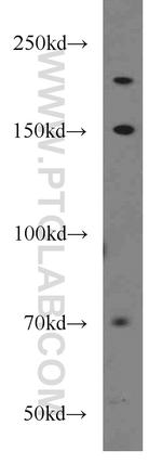 UBE2O Antibody in Western Blot (WB)
