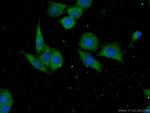 RFK Antibody in Immunocytochemistry (ICC/IF)