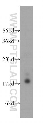 RFK Antibody in Western Blot (WB)