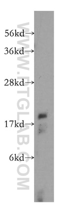 RFK Antibody in Western Blot (WB)