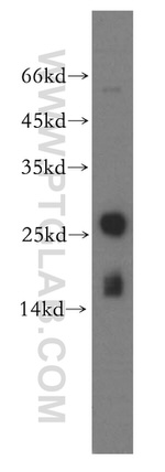 MYL1 Antibody in Western Blot (WB)