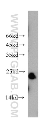 MYL1 Antibody in Western Blot (WB)