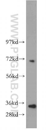 RHAMM/Lgals9 Antibody in Western Blot (WB)
